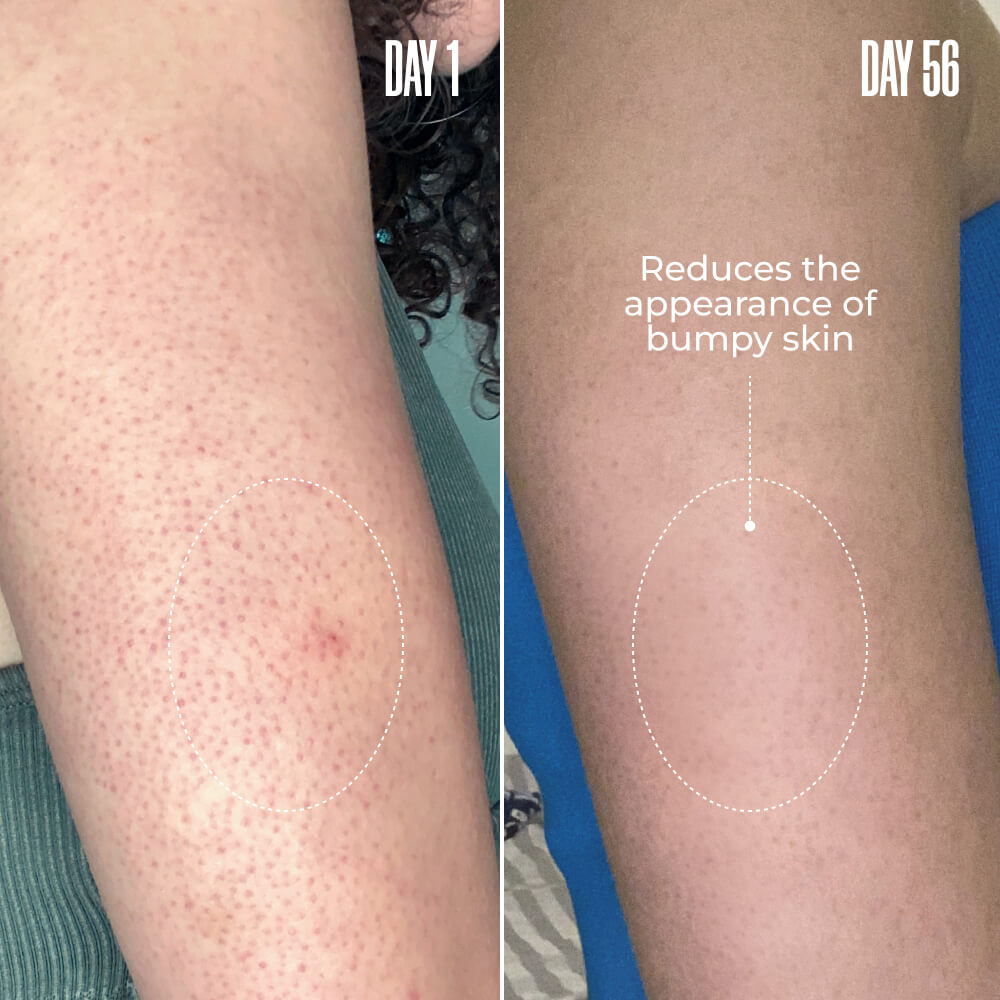 Resurfacing Body Serum product